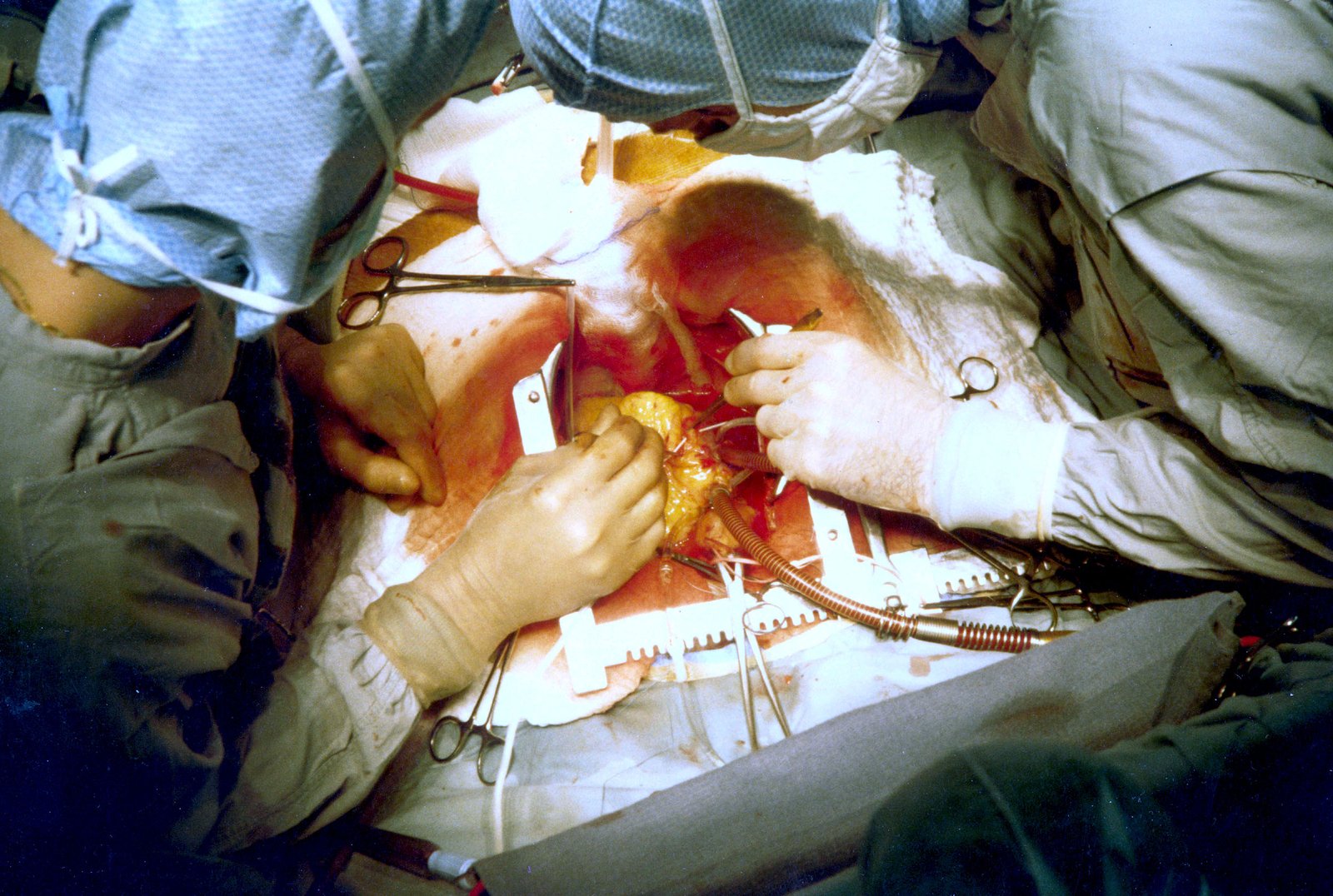 Service Image